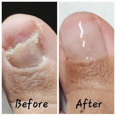 keryflex before and after