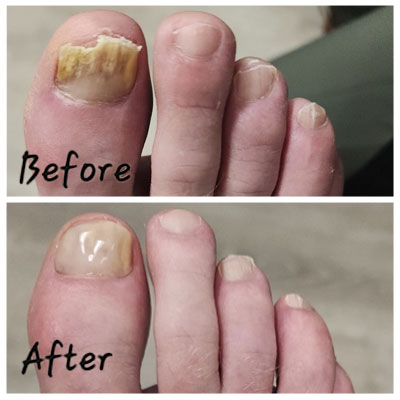 keryflex before and after